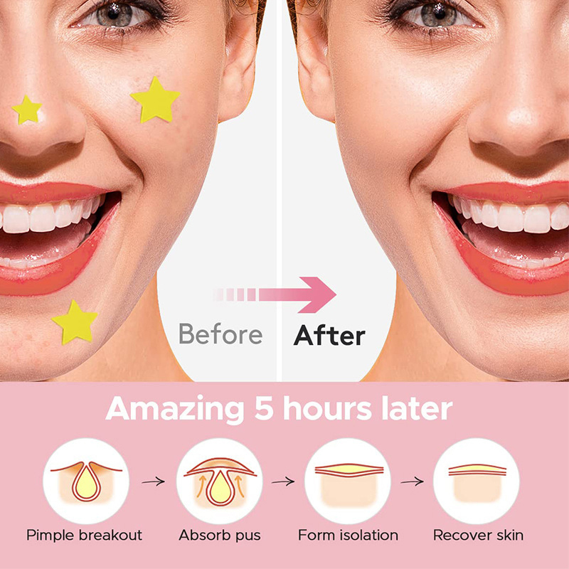 600Pcs/set Star Pimple Patch A - đánh giá và giá Beauty & Makeup Katia Di Paola